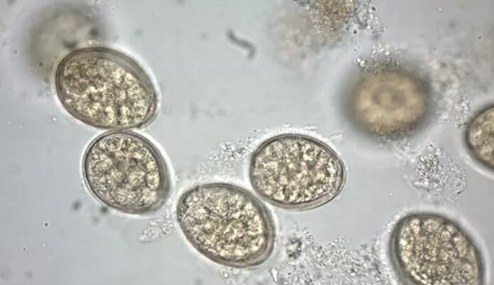 parasit di bawah mikroskop