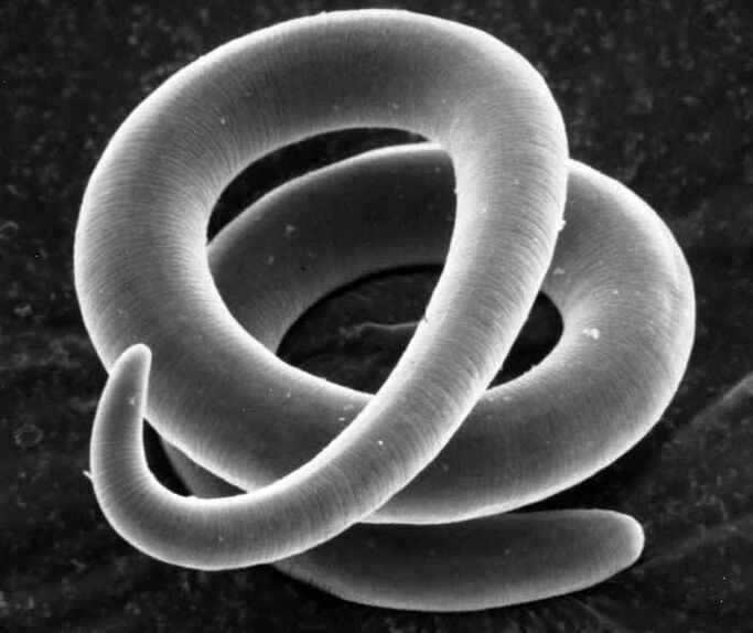 Trichinella di bawah mikroskop